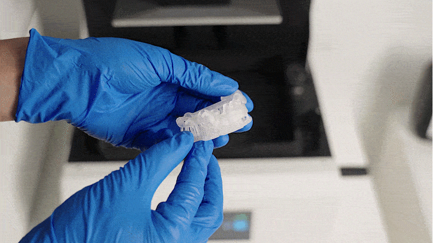 HSP Technology & Intelligent Support: 超低サポートピーリングフォース