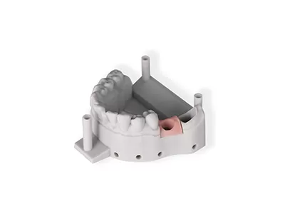 ソフトピンク2.0レジン