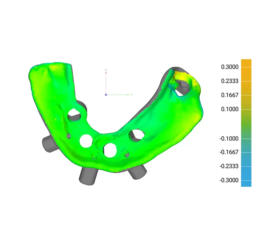 エッジE2歯科3Dプリンターが異なる理由